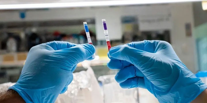 CHEMSTRIP COVID19 AG: Un nuevo kit nacional de testeo de antígenos